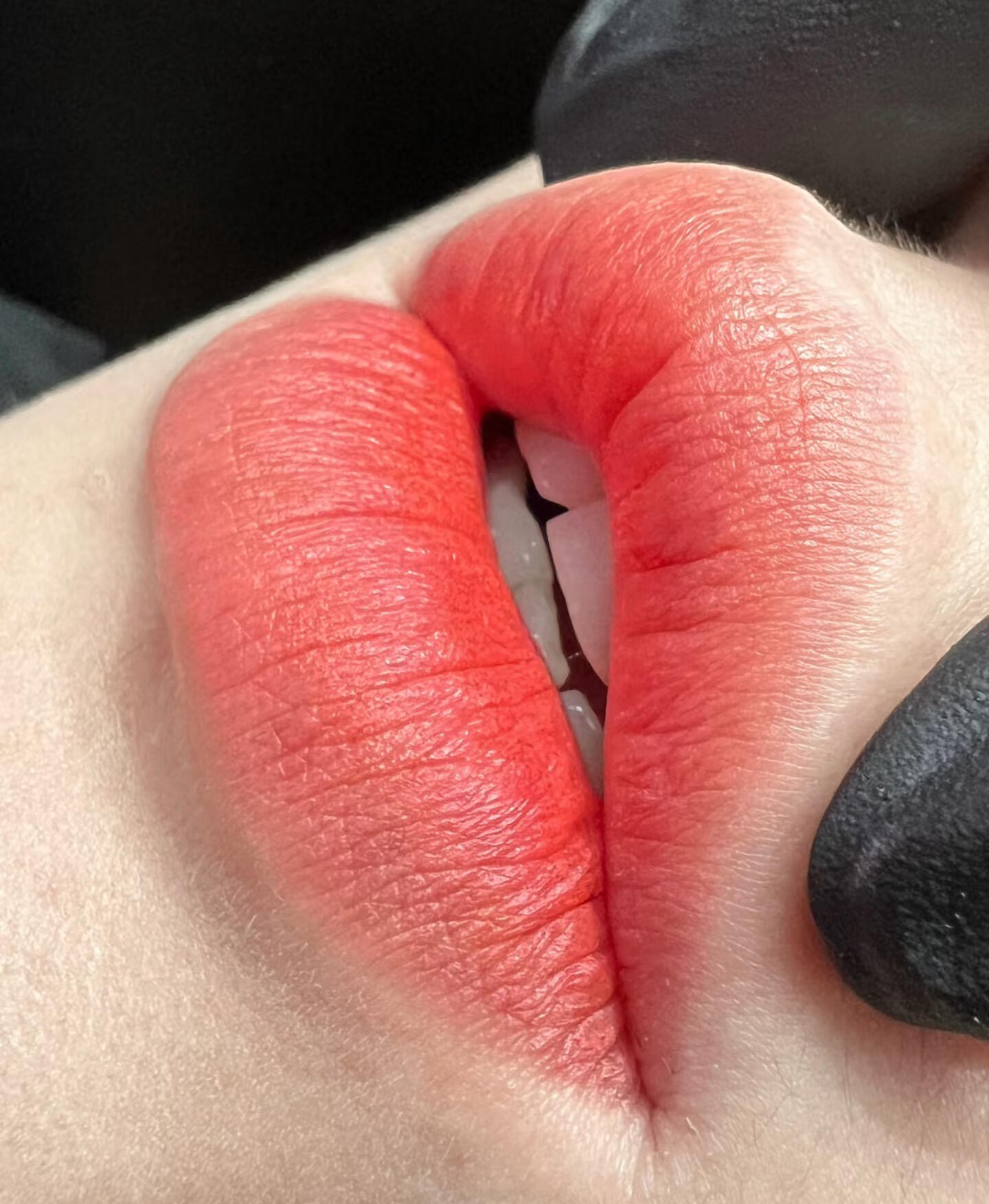 Even-Toned, Rosy Lips with Lip Blush Treatment Lips after lip blush treatment displaying a soft, natural pink tint.